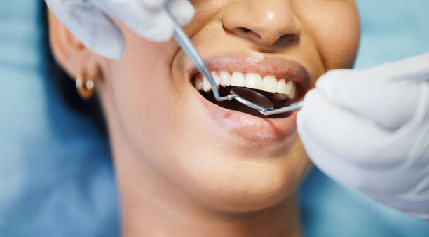 Best Knocked-Out Tooth Emergency  in Culver City, CA